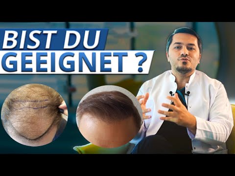 Haartransplantation: bist du geeignet?