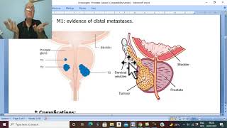 Urosurgery in Arabic 36 (Prostate Cancer, part 1 ) , by Dr. Wahdan