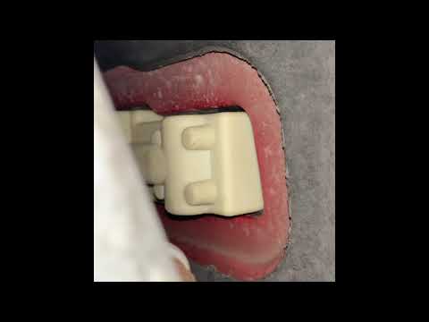 YouTube video about: What is the part time light on a jeep liberty?