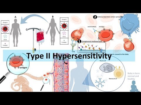 Type II hypersensitivity
