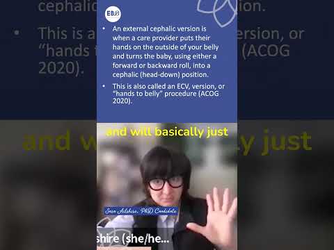 What is an External Cephalic Version (ECV)? Turning a Breech Baby