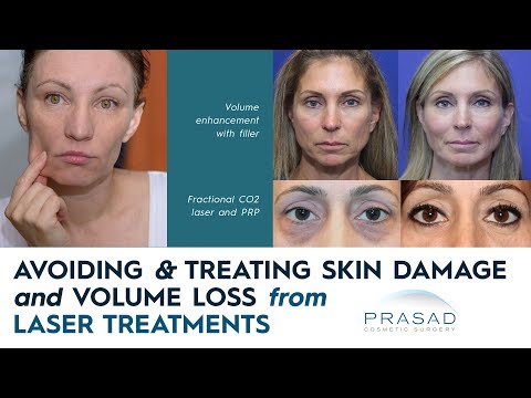 How Skin Damage and Volume Loss from Laser/Thermal Treatments are Avoided and Treated