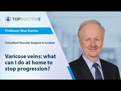Varicose veins: what can I do at home to stop progression? - Online interview