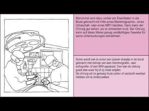 Bewertungen von Prostata-Entnahmen Steinöl therapeutische Eigenschaften der Prostata