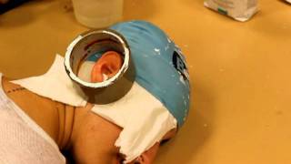 Construcción Oreja   MODO2 con Alginato Parte1ª