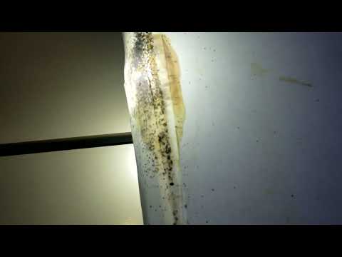 Bed Bugs Have Taken Over this Home in Peapack, NJ