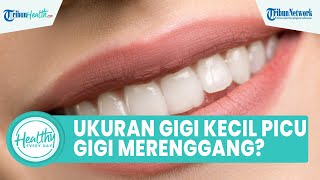 Benarkah Ukuran Gigi Terlalu Kecil Memicu Gigi Renggang? Berikut Jawaban drg Ardiansyah