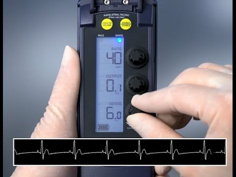Sensing and Threshold Test — 53401 Temporary Pacemaker
