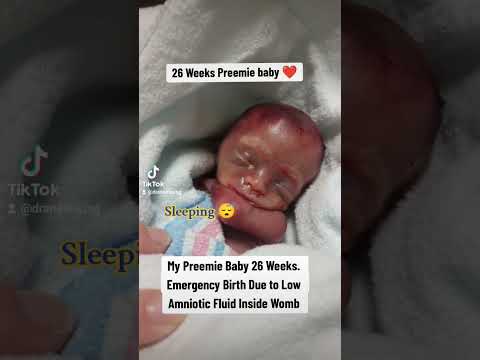 Preemie baby of 26 Weeks #baby #pregnancy #preemiebaby #preemie