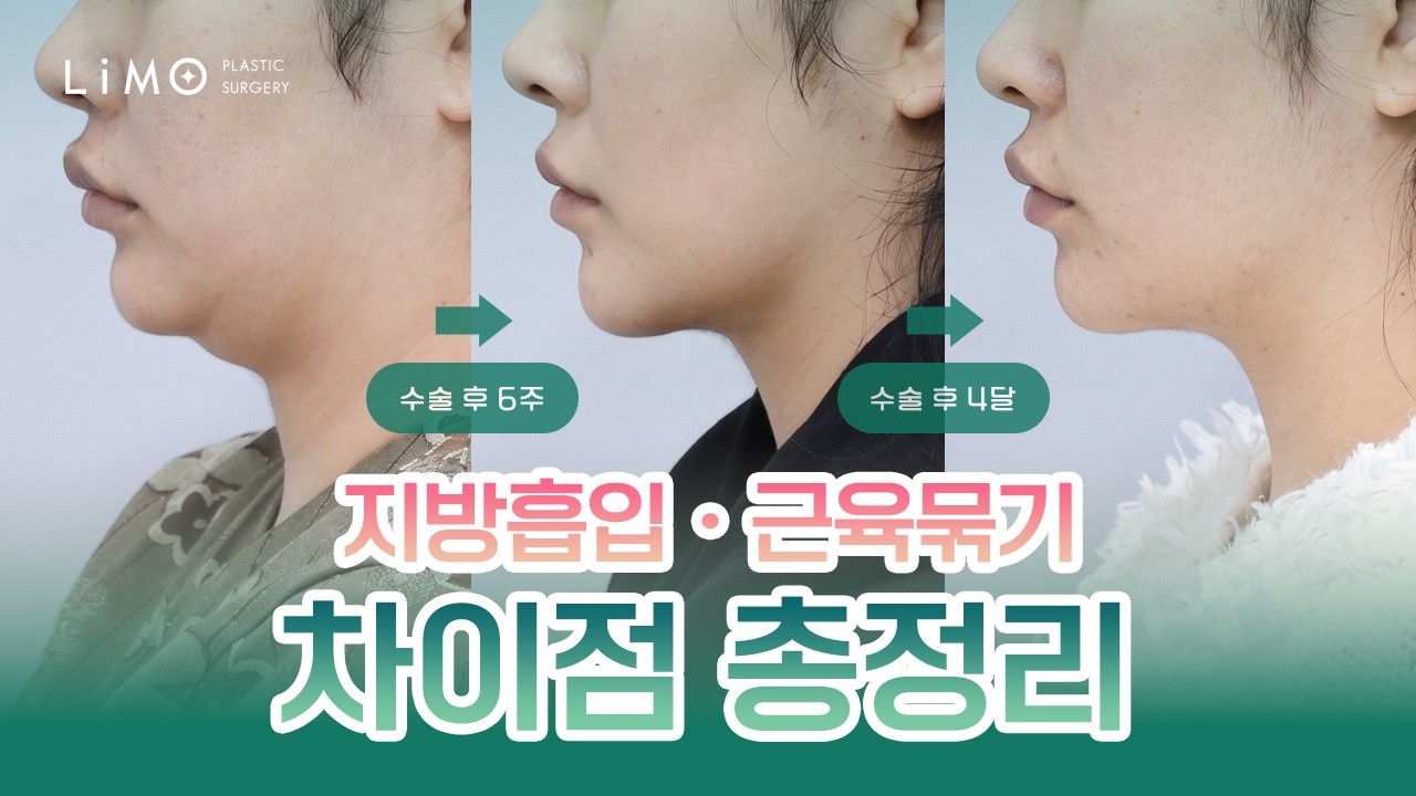 리모성형외과 유튜브 영상