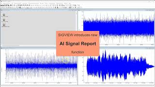 SIGVIEW AI Signal Report — Let an AI Engine Explain Your Signals