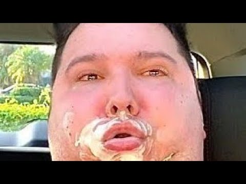 Nick Avocado Asshole