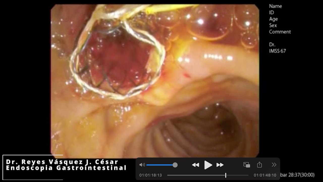 J. César Reyes Vásquez-36