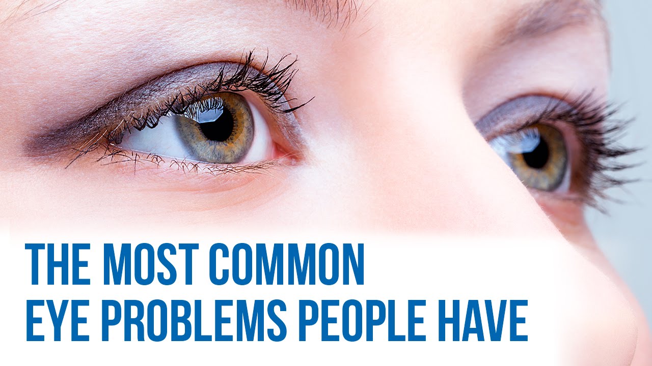 Common eye problems
