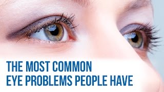 Common eye problems
