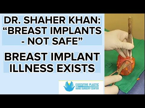 BREAST IMPLANT ILLNESS EXISTS -- DR. SHAHER KHAN: "ALL IMPLANTS ARE NOT SAFE"