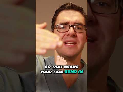 Why Is My Sprained Ankle Still Swollen After 3 6 or 12 MONTHS