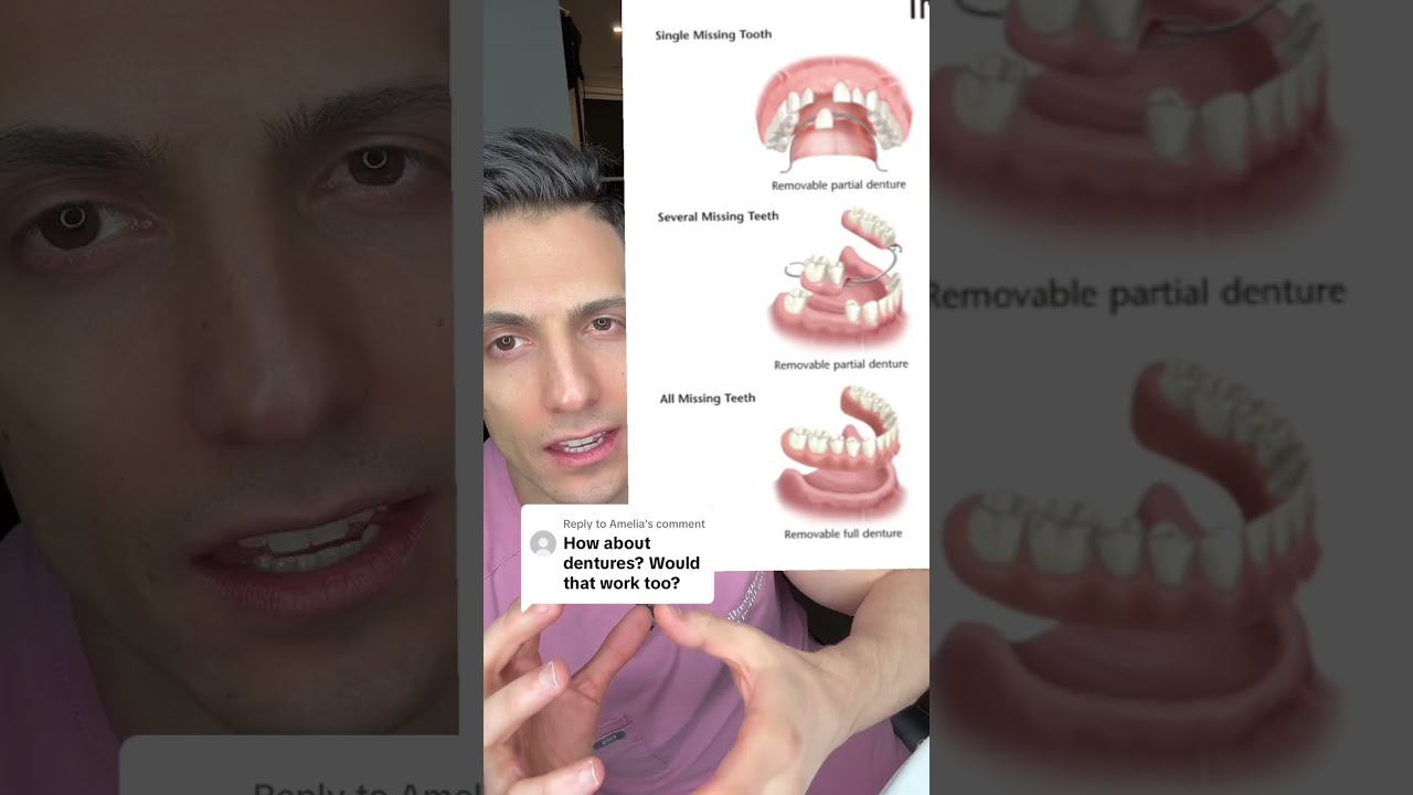 Will Dentures work overtime?