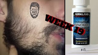 Minoxidil Beard | Week 19 | The Experiment | #FacialFuzzFridays