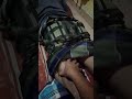 Terapi Pijat Refleksi Plus Terapi Bekam