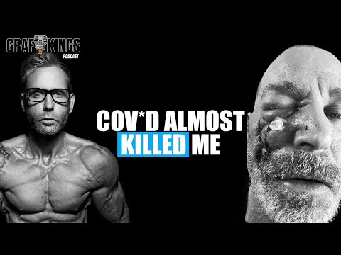 I Survived The Rarest Case of Covid | Scott Alexander