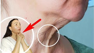 How to get rid of TURKEY NECK | Tighten loose skin on the neck, Saggy neck