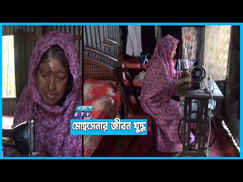 এসিডে ঝলছে দিয়েছিলো স্বামী