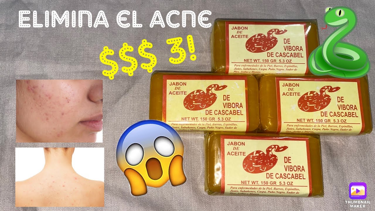 Watch video COMO ELIMINAR EL ACNE/ESPINILLAS | NADIA'S BEAUTY Now COMO ELIMINAR EL ACNE/ESPINILLAS | NADIA'S BEAUTY