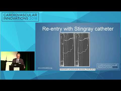 CVI2018 Session: Crossing devices for tibial CTOs