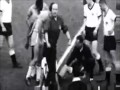 Pelé - The most violently fouled player in football history