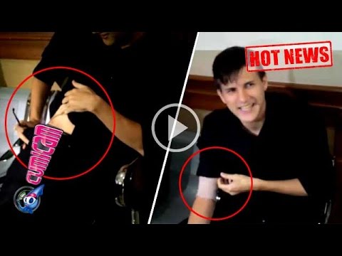 Ini Bukti Stuart Cedera Parah - Cumicam 03 Maret 2016