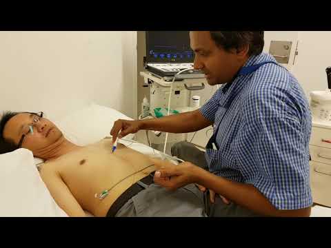 Transthoracic Echo for Beginners Part 3 of 3 - the LUCC Way - Subcostal View & IVC