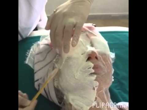 Anubis Barcelona in Helios Clinic for demonstration of Vitamin C and Lifting trends