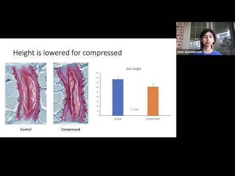 <p><span style="color: rgb(0, 0, 0);">High Strain Dynamic Loading Induces Early Signs of Degeneration in Intervertebral Discs</span></p>