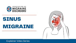 What is Sinus Migraine? - Chapter 1: Migraine Types - Explainer Video Series