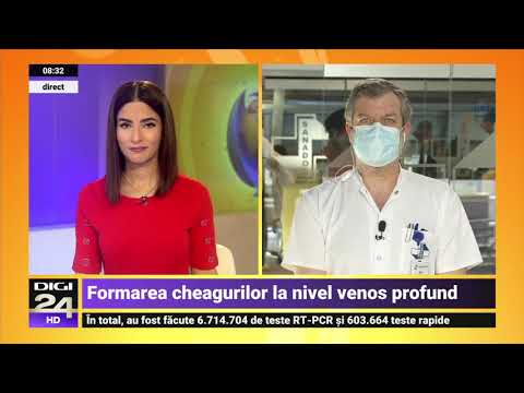 tratamentul varicozei varicoza în letonia aplicarea peroxidului în varicoza