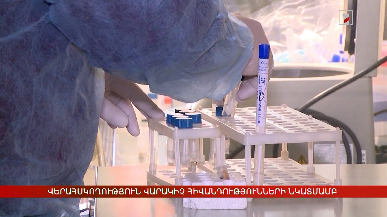 Վերահսկողություն վարակիչ հիվանդությունների նկատմամբ