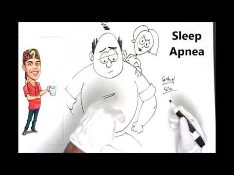 Sleep Apnea Facts Explained Simply