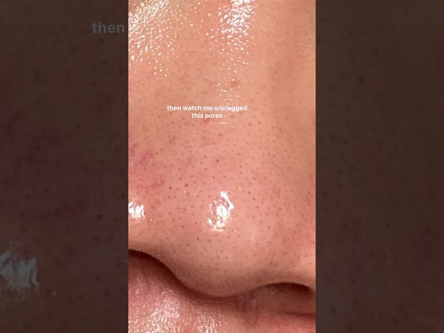 Vídeo relacionado con TONYMOLY Wonder Apricot Seed Deep Cleansing Oil - Makeup Blackhead Remover, Deep Cleansing K-Beauty Skincare, 190ml