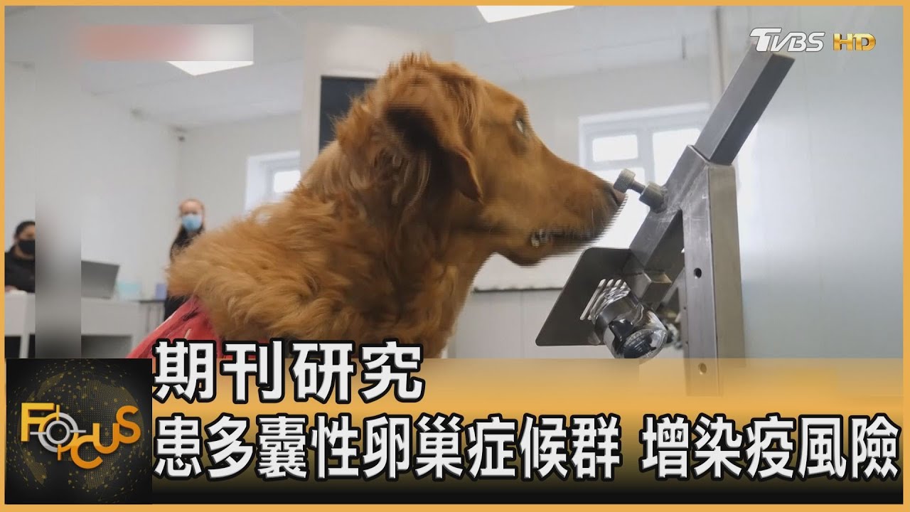 期刊研究 患多囊性卵巢症候群.增染疫風險