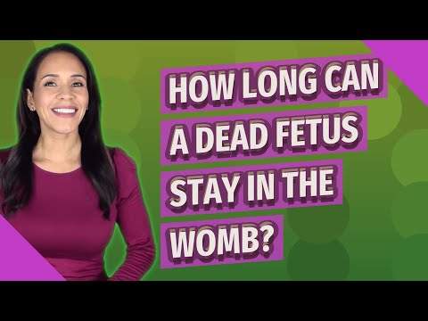 How long can a dead fetus stay in the womb?
