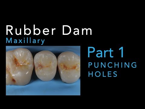 Rubber Dam - PART 1: Punching Maxillary Holes