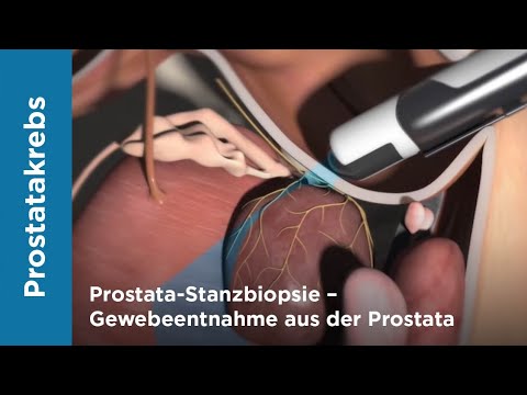 Wie zu finden und die Prostata-Massage Prostatilen Zink Apotheke Seen