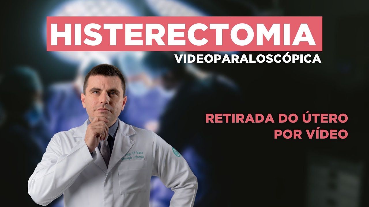 HISTERECTOMIA Videolaparoscópica - RETIRADA do ÚTERO por Vídeo