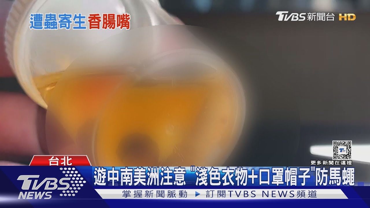 秘魯返台「腫成香腸嘴」 男唇內活捉3幼蟲