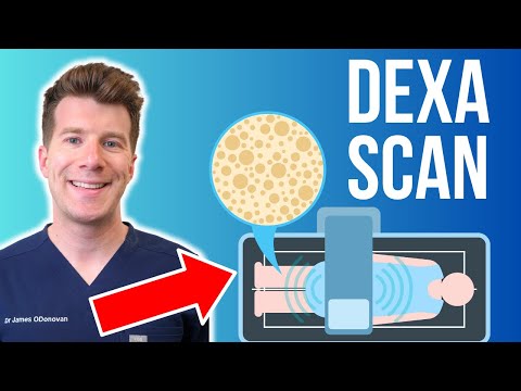 Doctor explains Bone Density Scan (DEXA / DXA scan)