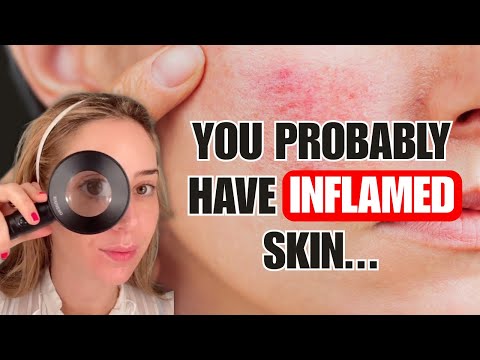 Inflammation–Aging Cycle Wrecking Your Skin? | Derm Guide to Redness & Longevity | Dr. Idriss