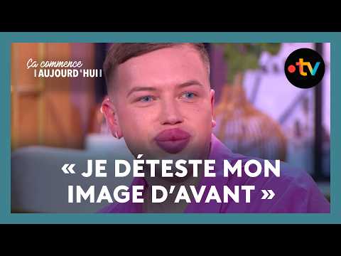 Chirurgie esthétique : dans sa quête de perfection, Yohan n'est jamais satisfait - CCA