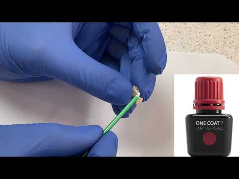 BRILLIANT Crios Reinforced Composite Bloc is the Ideal Choice for Permanent Single Tooth Restoration