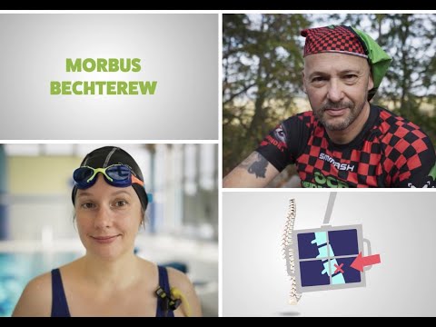 Erklärfilm zu Morbus Bechterew von der DVMB - Deutsche Vereinigung Morbus Bechterew e.V.